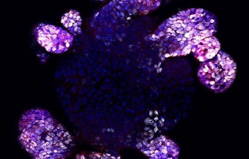Fluorescent picture of an intestinal organoid