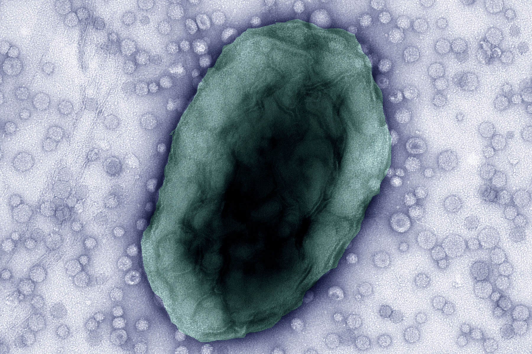 Bacteroides thetaiotaomicron cell