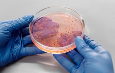 Bacteria in a Petri dish