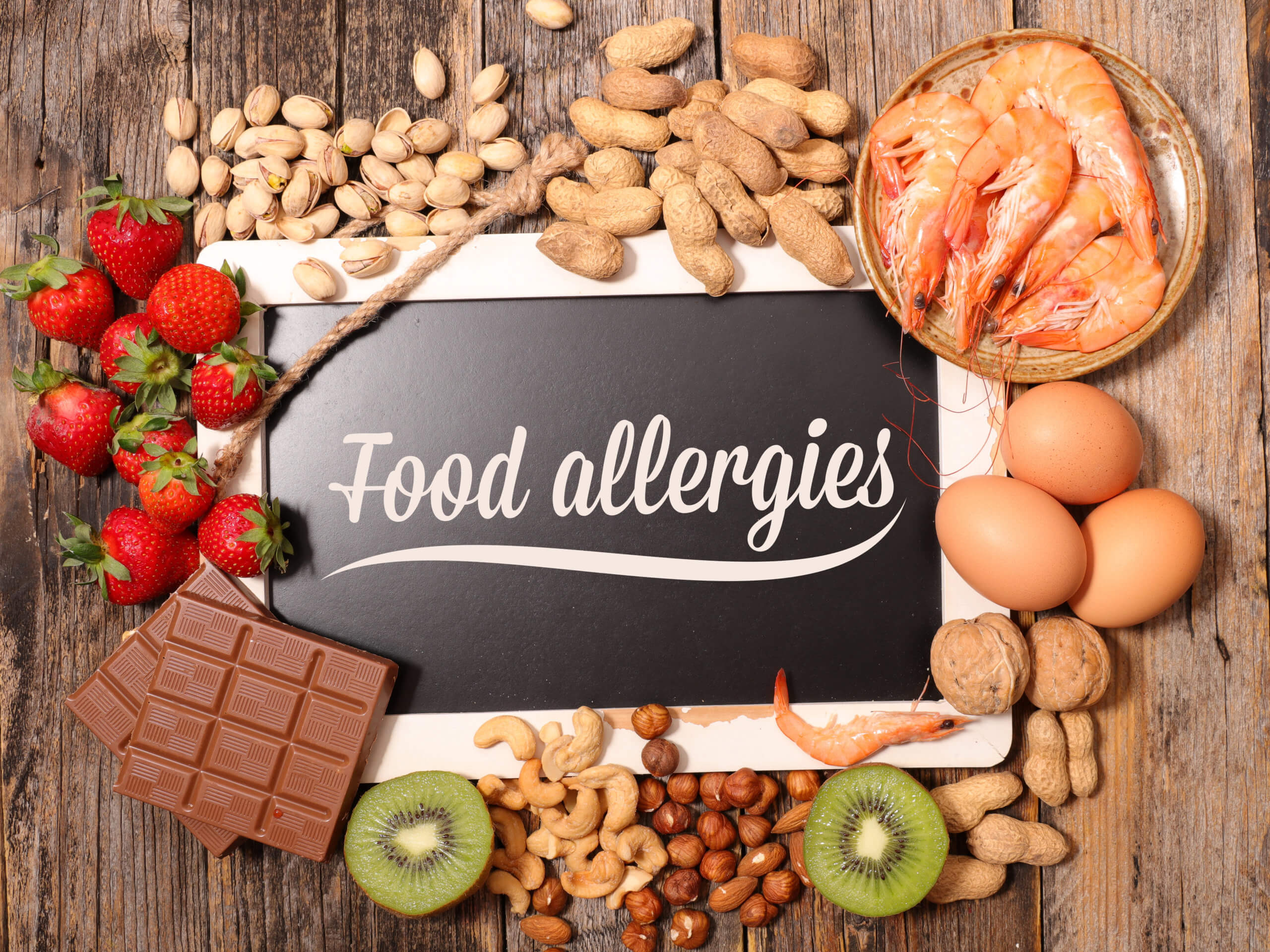 Food allergies sign