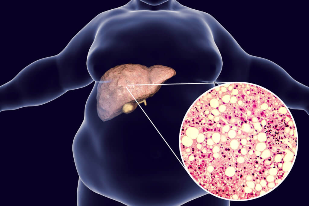 Researchers turn attention to protein drug as potential liver disease intervention