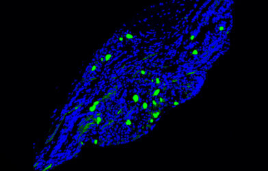 Vagal neurons that carry signals from the gut to the brain