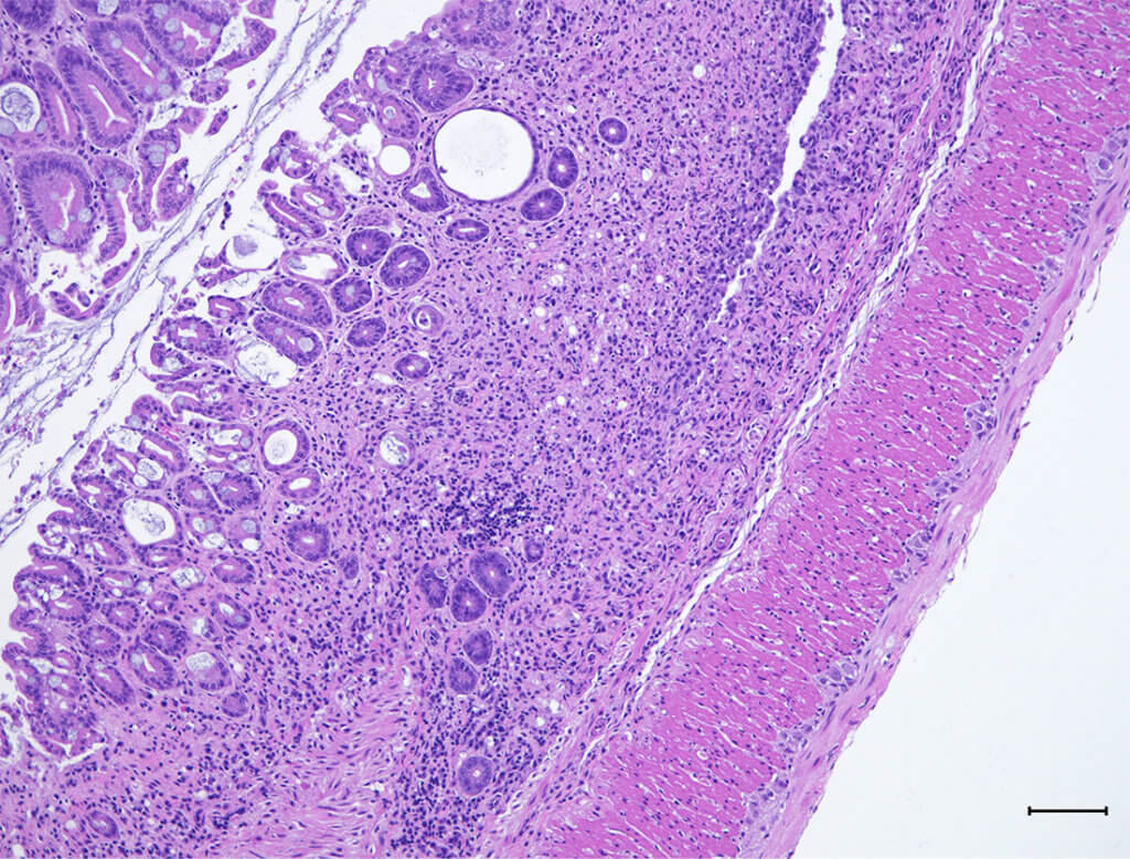 Histology showing colon tissue damage of mice lacking the Pak2 gene.