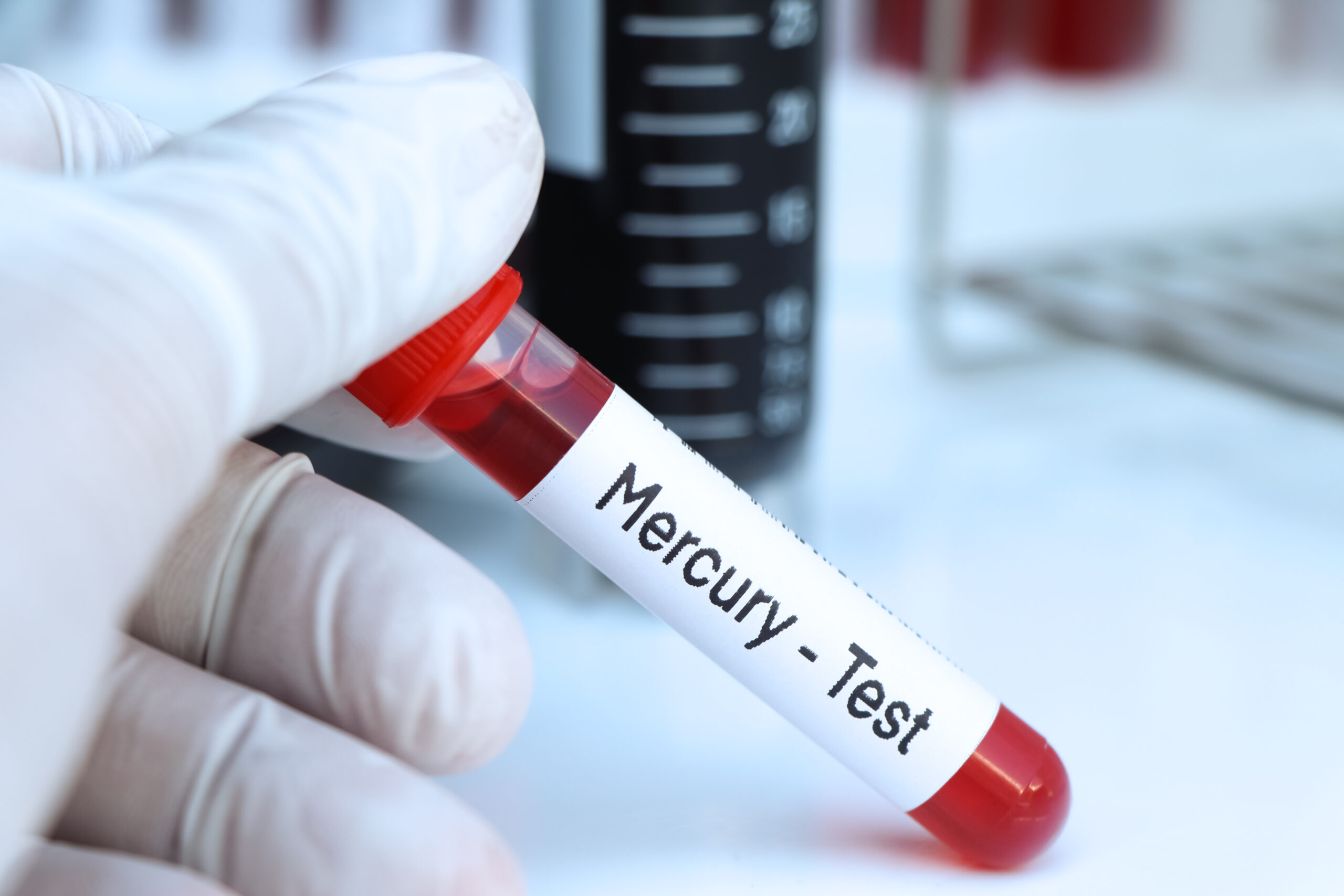 Mercury blood test